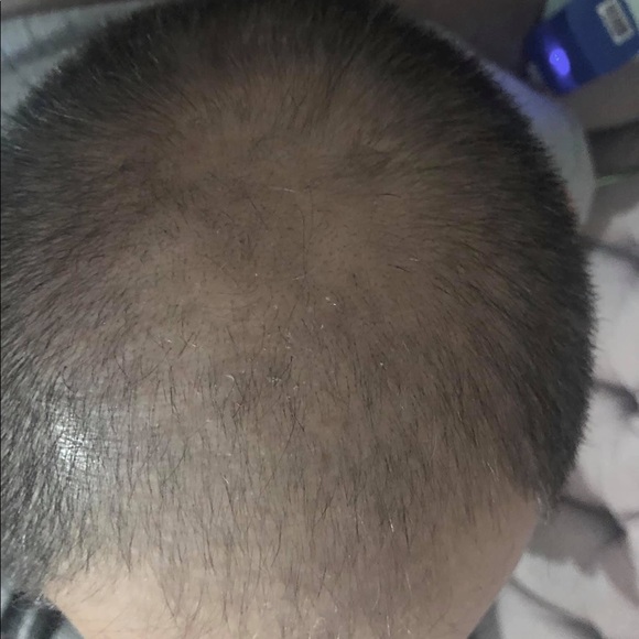 Sorduse huile capillaire pour cheveux - Picture 2 of 6